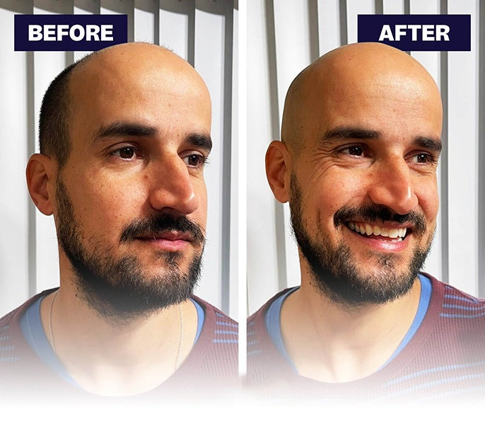 Effortless Head Shaving: Must-Have Shaver For Bald Guys