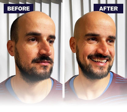 Effortless Head Shaving: Must-Have Shaver For Bald Guys